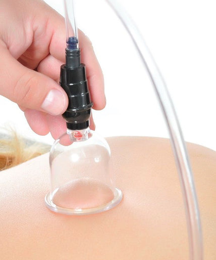 FETISH FANTASY SERIES - 6-PIECE SUCTION SET FETISH FANTASY SERIES - 6-PIECE SUCTION SET